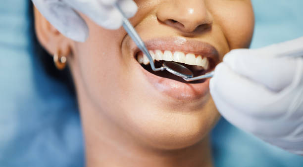 Best Emergency Denture Repair in Hays, MT