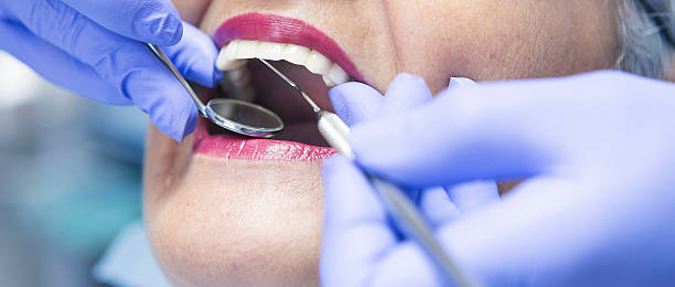 Best Emergency Denture Repair in Hays, MT