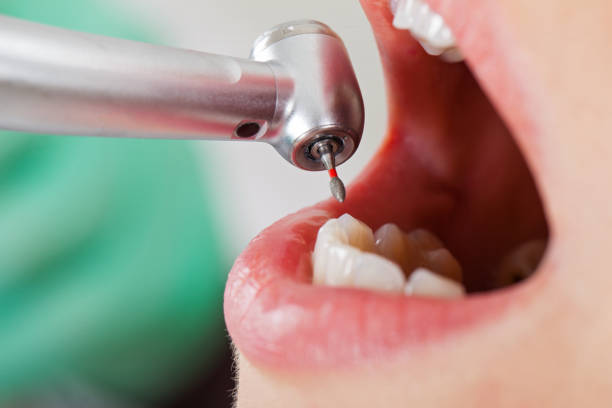 Best Emergency TMJ Treatment in Hays, MT